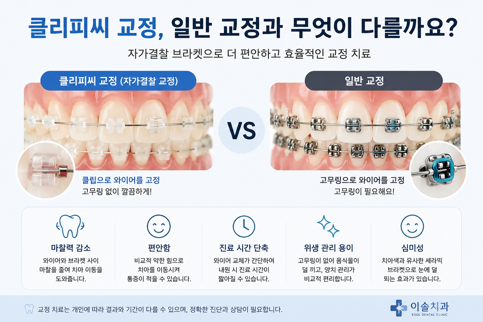 클리피씨 교정, 일반 교정과 무엇이 다를까요?