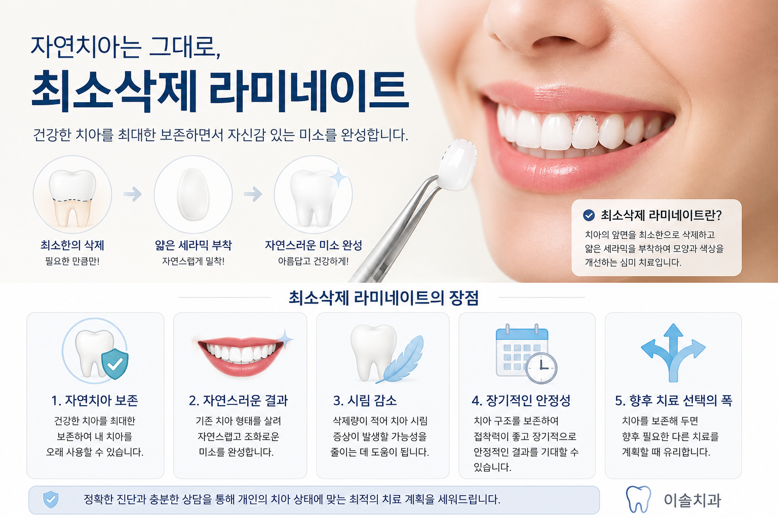 최소삭제 라미네이트에 대한 설명
