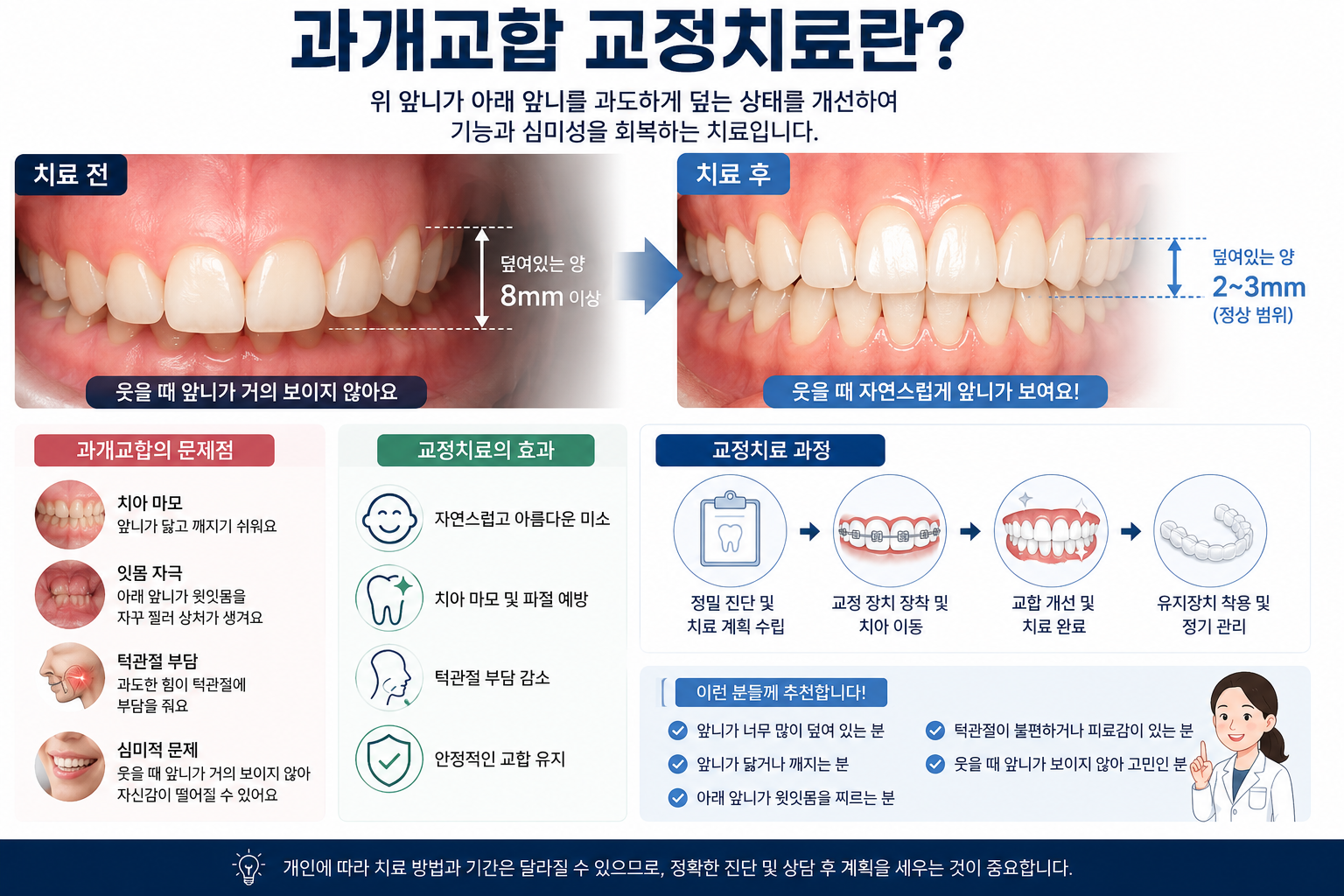 깊게 물리는 앞니 (과개교합)치료에 대해 치과교정과 전문의가 알려드립니다