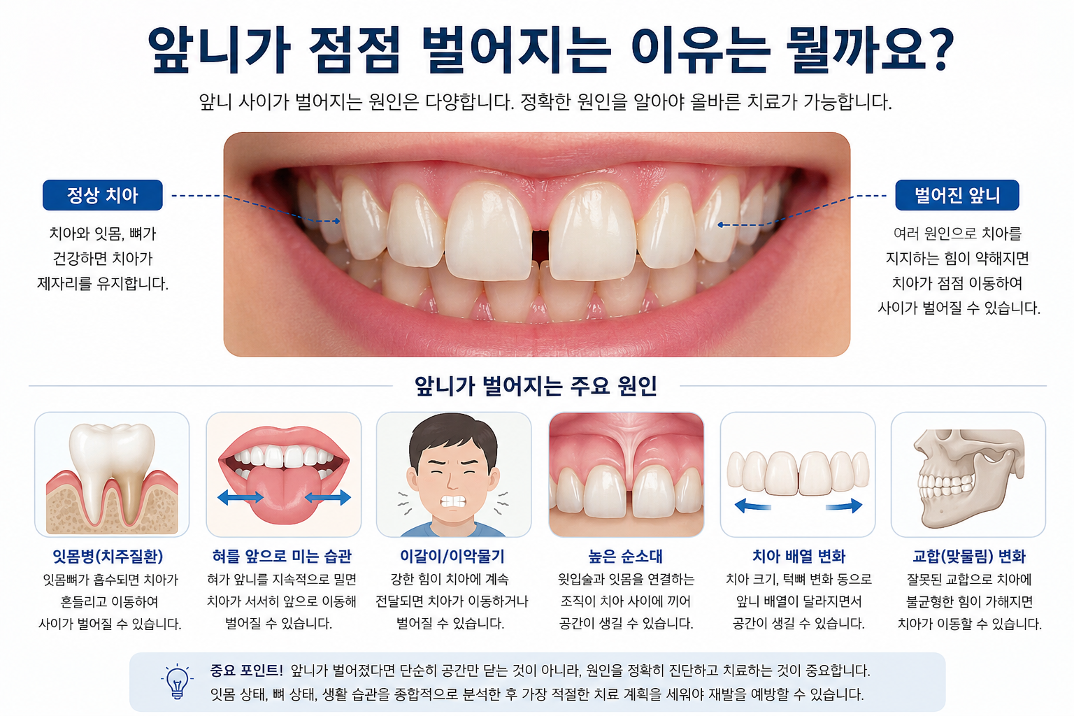 점점 벌어지는 앞니, 왜 생길까요? 원인과 치료 방법 총정리