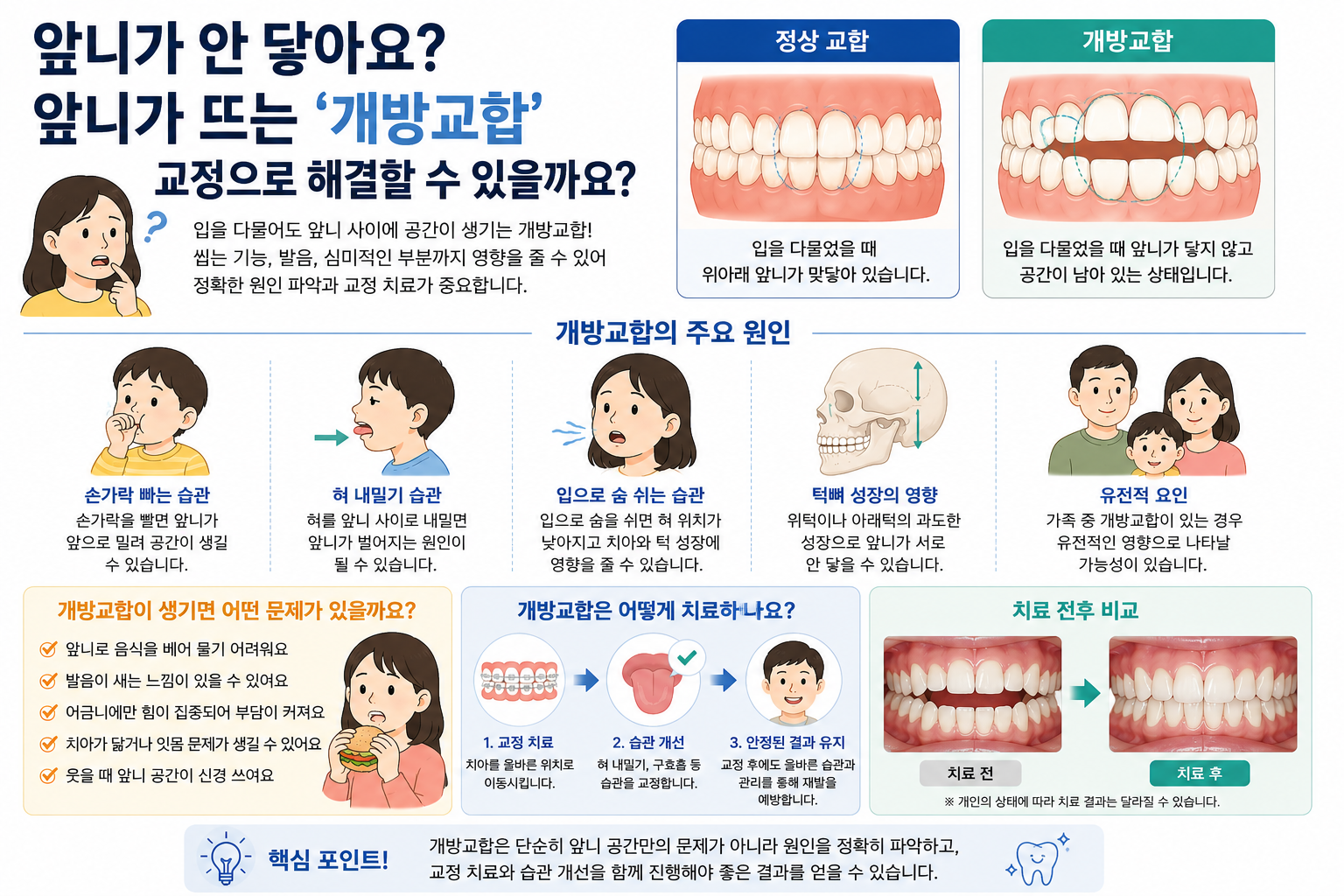 개방교합, 앞니가 안 닿는 이유와 치료 방법은?